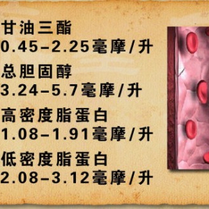 养生堂20130211视频:武剑讲脑梗死、高血压和脑血管疾病、脑血管斑块的形成和危害