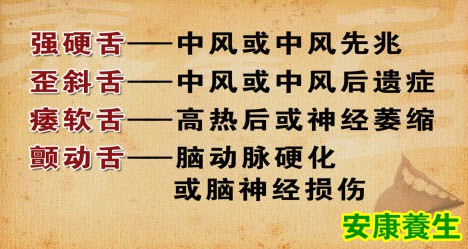 健康的舌象什么样