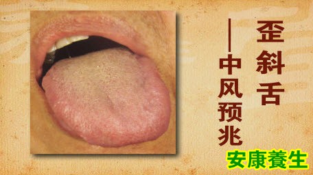 健康的舌象什么样