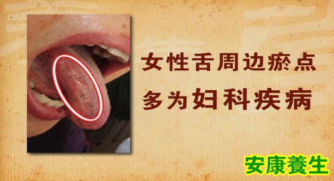 健康的舌象什么样