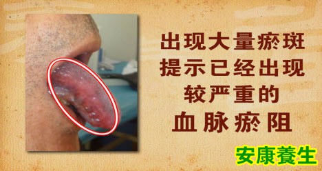 健康的舌象什么样