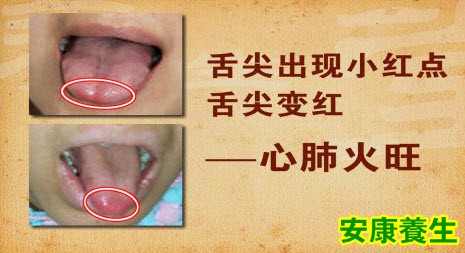 健康的舌象什么样