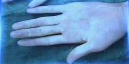 遇冷手指变紫红需警惕免疫性疾病