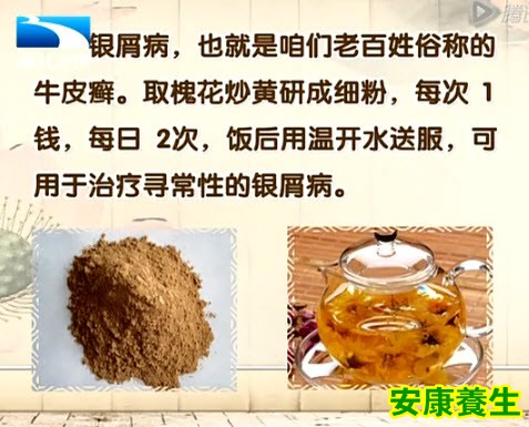 槐花治疗银屑病（牛皮癣）