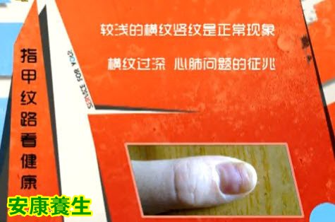 指甲纹路看健康