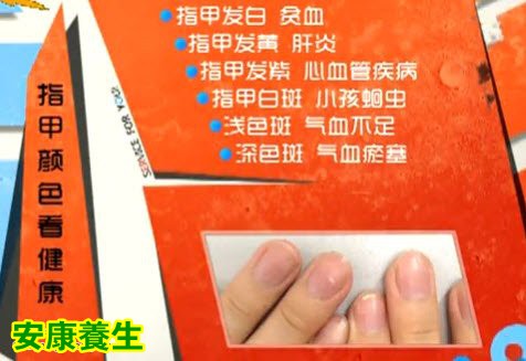 指甲颜色透露的疾病征兆