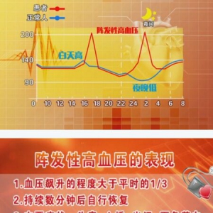 养生堂20170929蔡军《“失控”的血压》阵发性高血压、定副神经节肿瘤