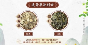 20211018健康之路:张景明,辨发识病,干性脱发调理方,透骨草洗剂方,补血祛风生发方