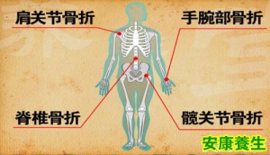 养生堂视频20130804薛庆云：告别“嗑”骨之痛（2）