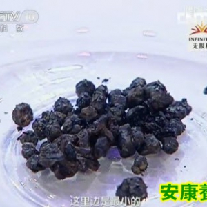 20130827健康之路视频和笔记:张洪义讲胆结石,胆囊,夜猫子,胆汁