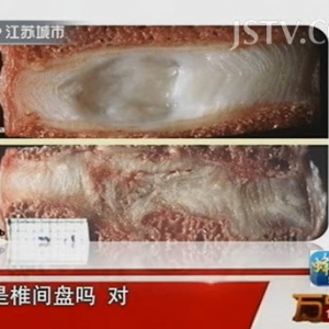 《腰椎之伤》朱峰讲腰椎,椎间盘突出,盘源性疼痛