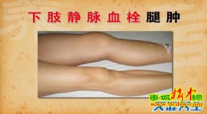 养生堂20130607 许俊堂：