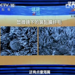 健康之路视频:周兵讲鼻涕 脑脊液漏 鼻窦 鼻痂