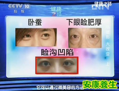眼袋