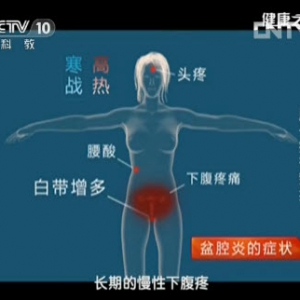健康之路视频魏丽慧:女性肚子疼的原因 子宫内膜异位症 盆腔炎 宫外孕相关内容