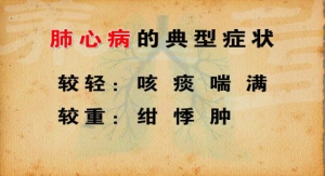 养生堂视频:周平安 姜苗讲肺心病的典型症状 病毒性心肌炎的典型症状