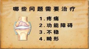 养生堂20130331视频:吕厚山讲人工关节材料的选择，人工关节置换的黄金年龄