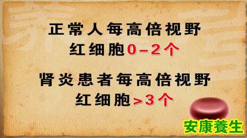 血尿的诊断标准