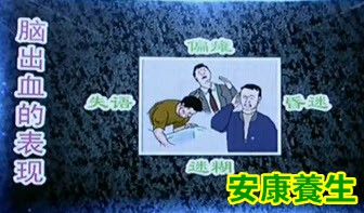 脑出血的表现