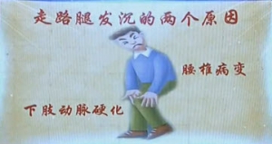 健康之路20131014视频:鞠上讲下肢动脉堵塞、走路腿发沉如何锻炼、腰椎病变引起的腿沉