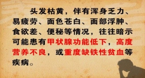 养生堂20131015视频:张广中讲头发颜色异常的危险、胎毛增多症、祛脂外洗方