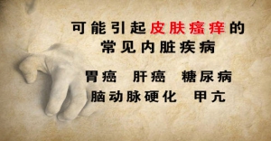 养生堂20131017视频:张广中讲皮肤瘙痒的常见内脏疾病、润泽全身皮肤、楮桃叶水剂的制  ...