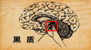 养生堂20131020视频:李勇杰讲如何预防或延缓帕金森病的发生、帕金森病的风险因素、特  ...