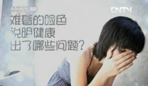 健康之路20131111视频:钱会南讲色斑产生的原因、长斑、色斑、祛斑、黄褐斑、祛斑