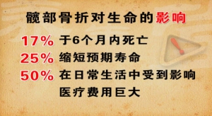 养生堂20131126视频:付中国讲髋部骨折对生命的影响、防老年人摔倒、平衡功能自测