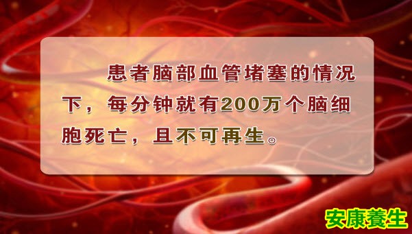 脑卒中如何急救