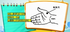 20140214健康有道视频和笔记:迷罗讲去除体内风寒,莲花凌波式,拍痧,双齐花茶