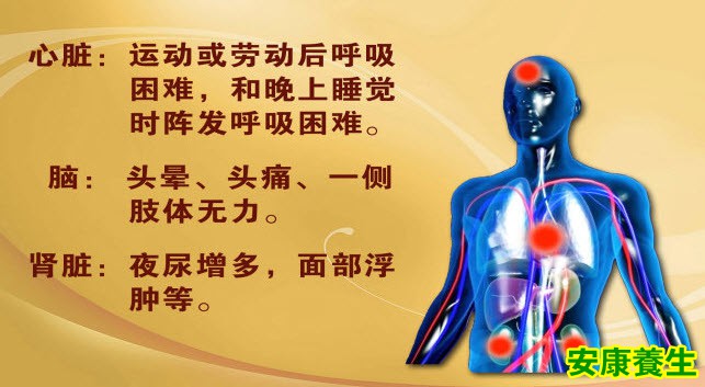 心血管疾病可能症状