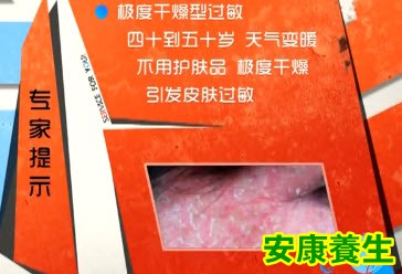 过敏的类型
