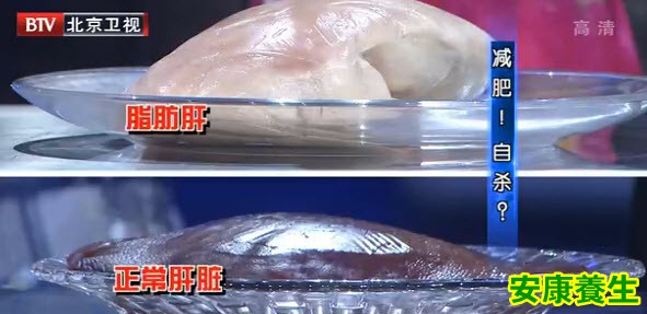 肝坏死