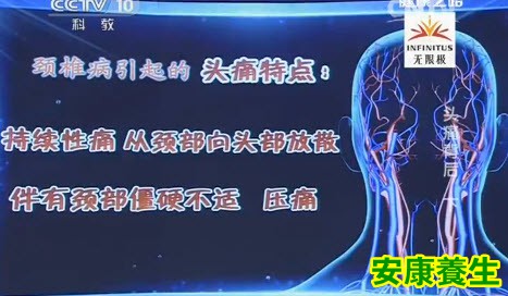 颈源性头痛