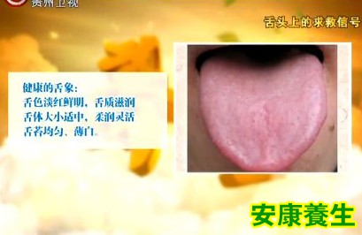 舌象
