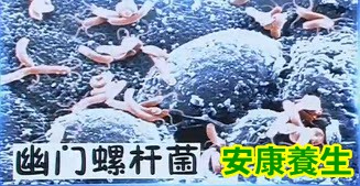 幽门螺杆菌