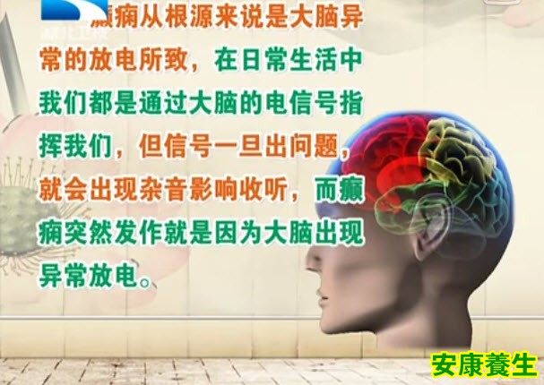 癫痫