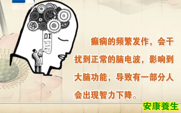 癫痫