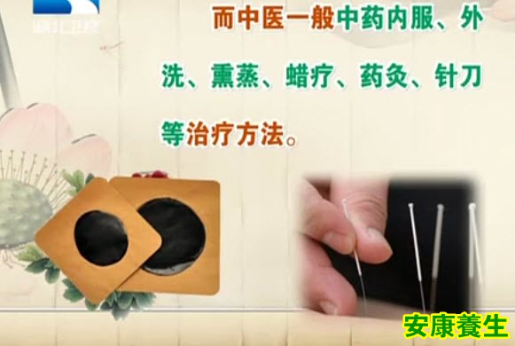 类风湿性关节炎