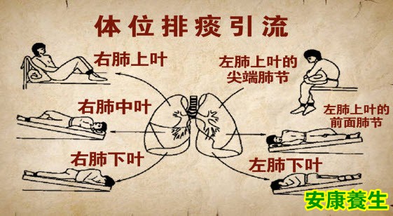 体位排痰引流