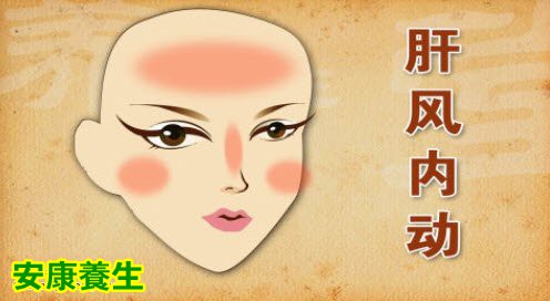 中风容易在哪些人群中发生