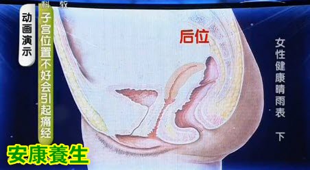 子宫位置不好与痛经关系最大