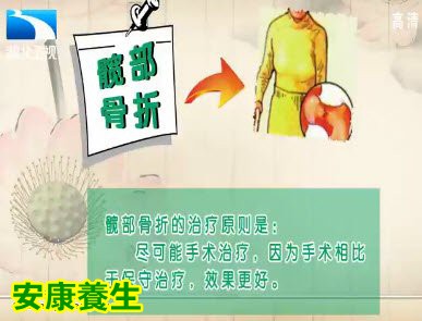 髋部骨折的治疗