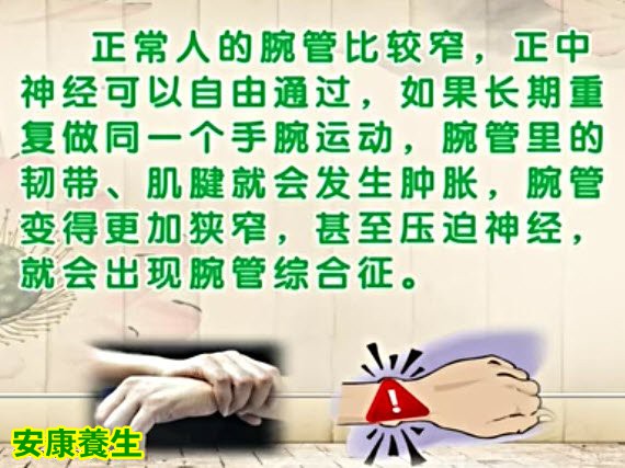 腕管综合征