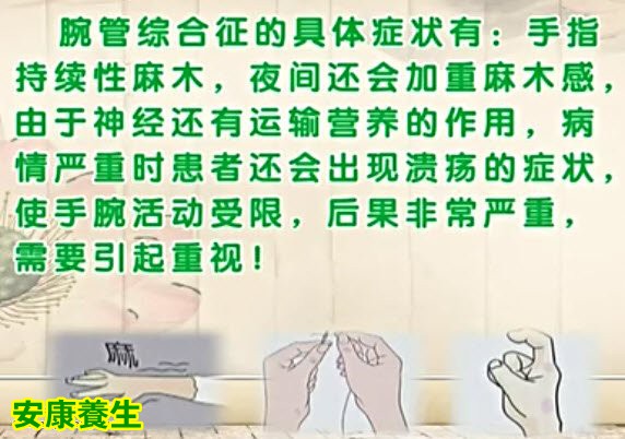 腕管综合征