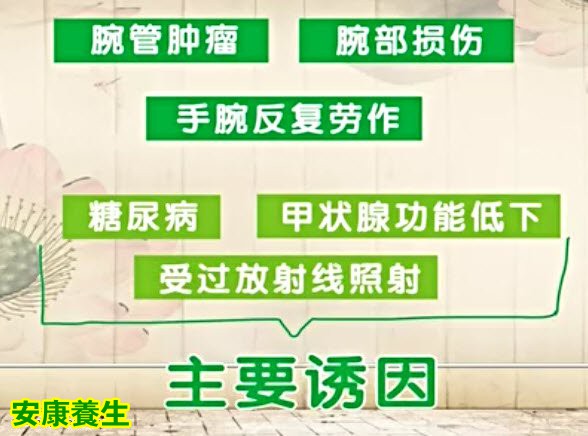 腕管综合征