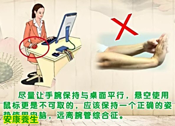 腕管综合征