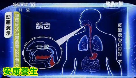 与胃食管反流有关的症状