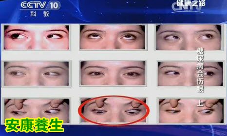 如何自查眼肌是否健康